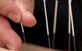 Acupuncture